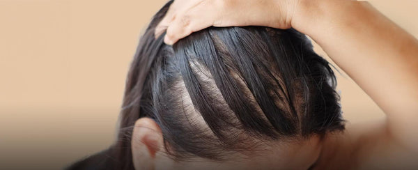 Are you concerned about hair thinning or loss?