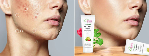 8 Ways Vitamin C Skincare Fights Aging & Dark Spots
