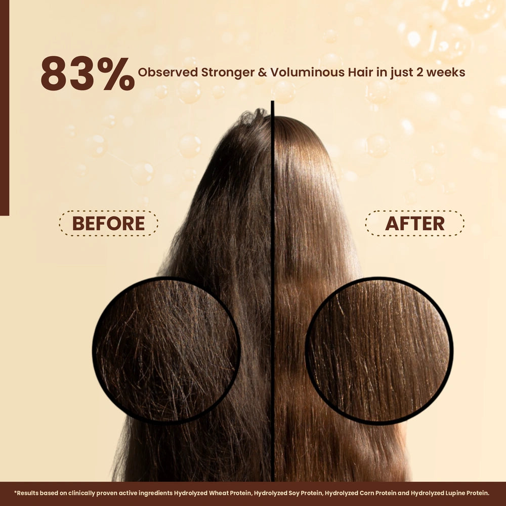 Lemon & Ginger Anti-Dandruff Shampoo 100% Nourishment & Scalp Care
