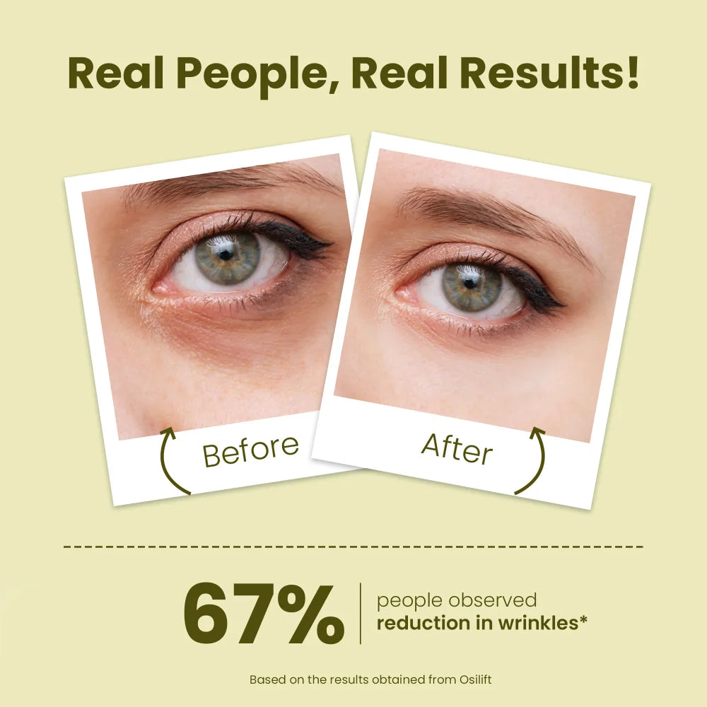 Under Eye Serum for Dark Circles & Puffy Eyes