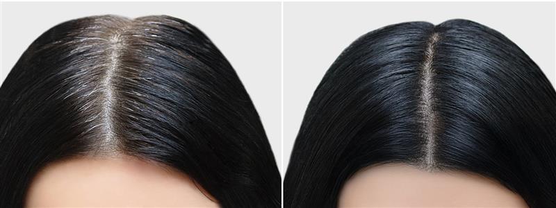 Maintaining Optimal Skin 