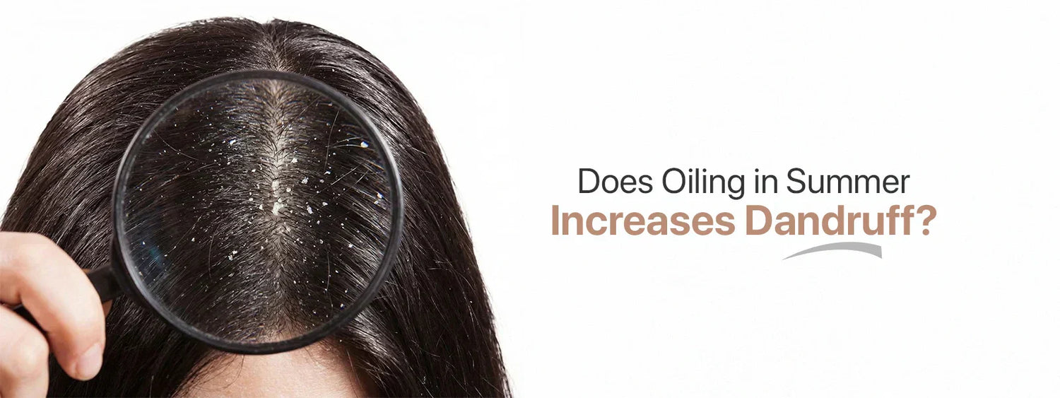 Person holding magnifying glass to dandruff on hair with text about dandruff and summer oiling.