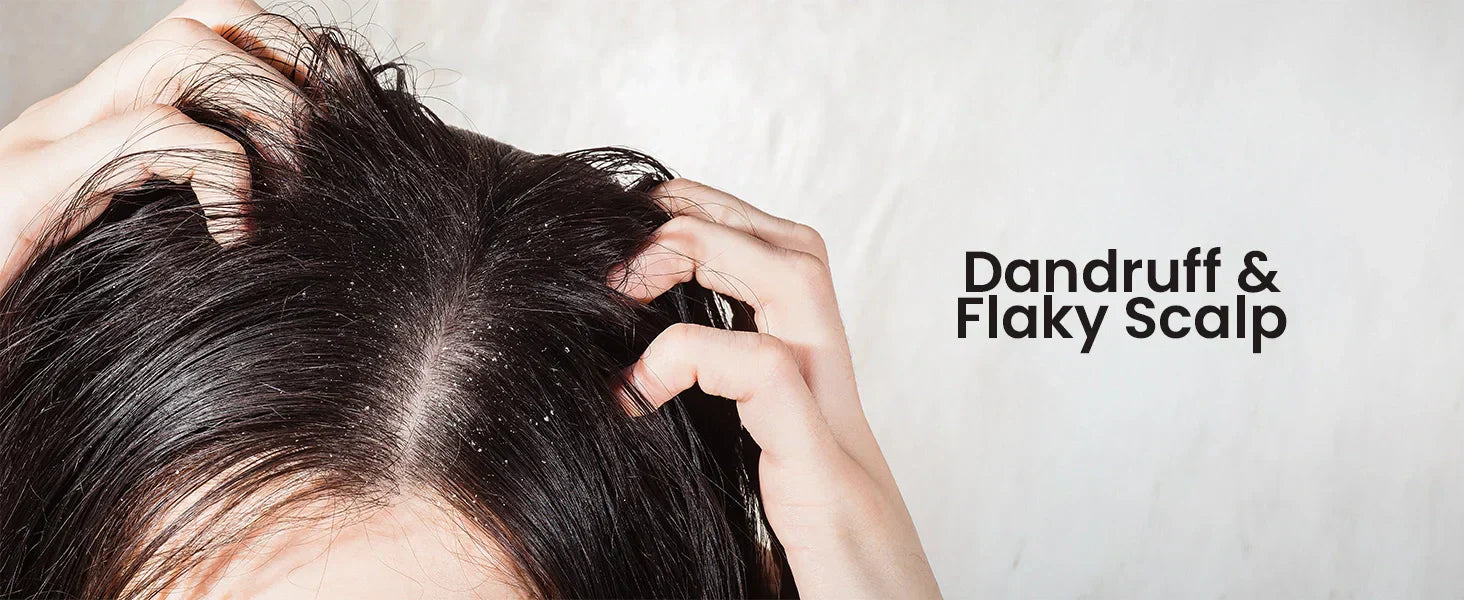 Dandruff & Flaky Scalp