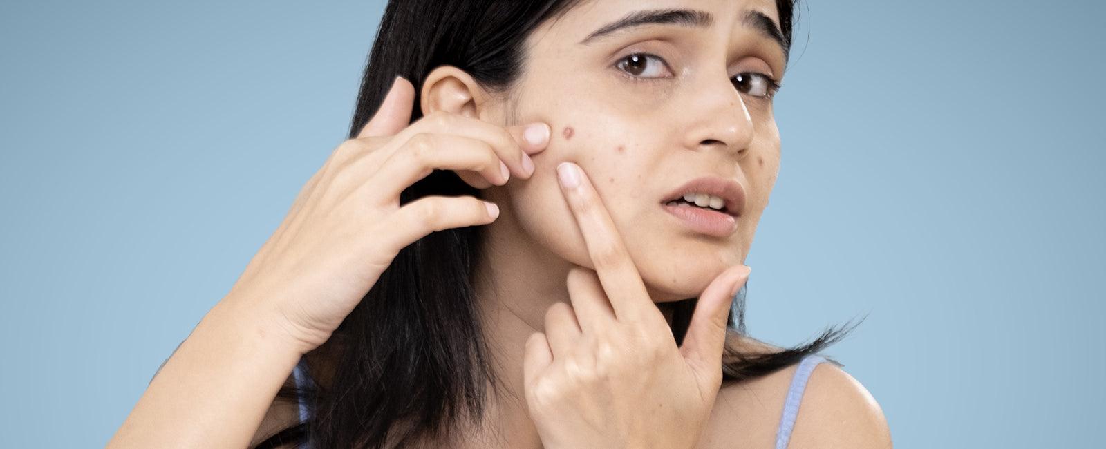 Waking Up to New Breakouts Every Morning? - La Pink