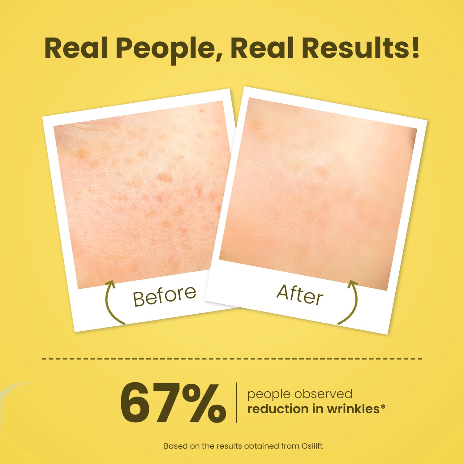 Before and after comparison of skin with a yellow background and text about wrinkles reduction.