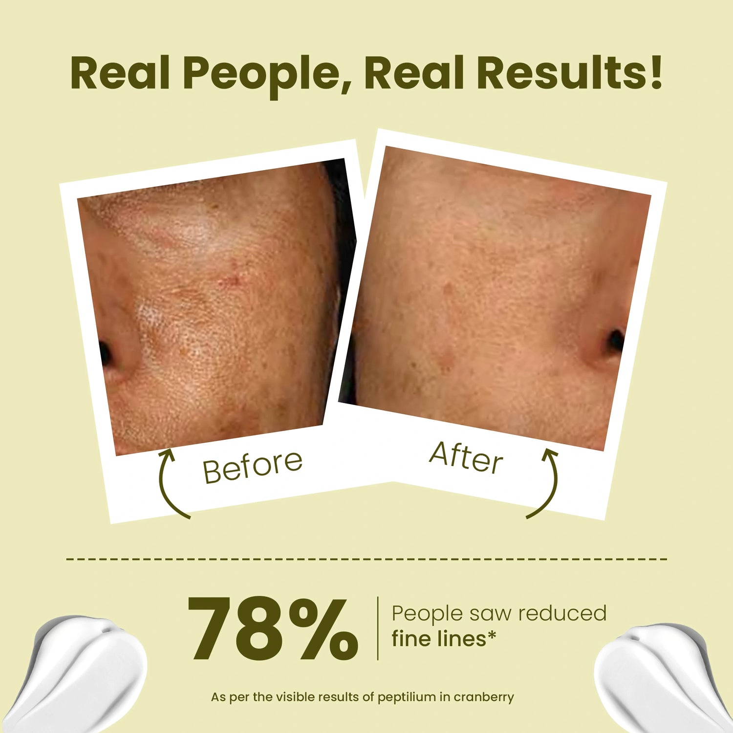 Before and after comparison of skin with reduced fine lines on a beige background.