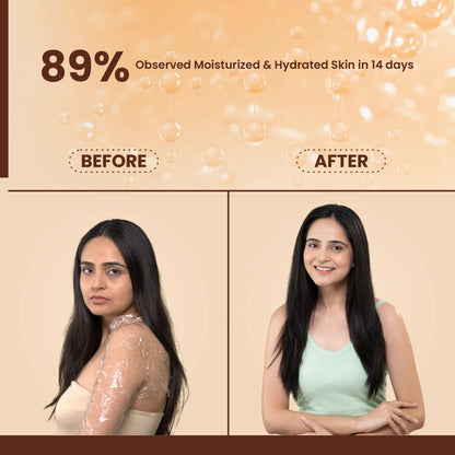 Before and after comparison of a woman&