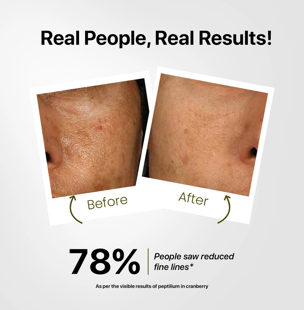 Before and after skin comparison with text 'Real People, Real Results!' and '78% saw reduced fine lines'.