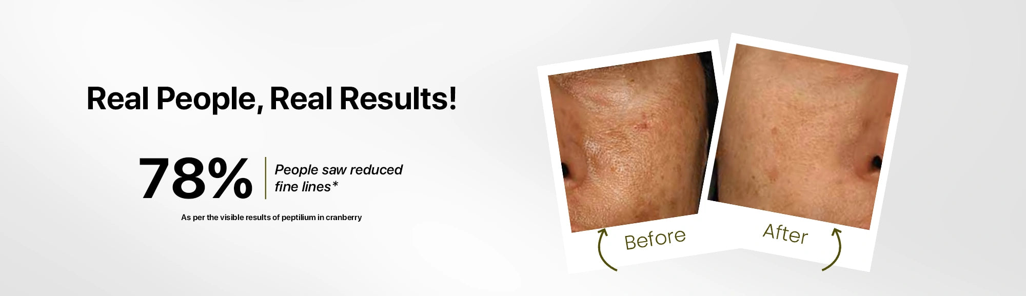 Advertisement showing 'Before' and 'After' skin results with text about reduced fine lines.
