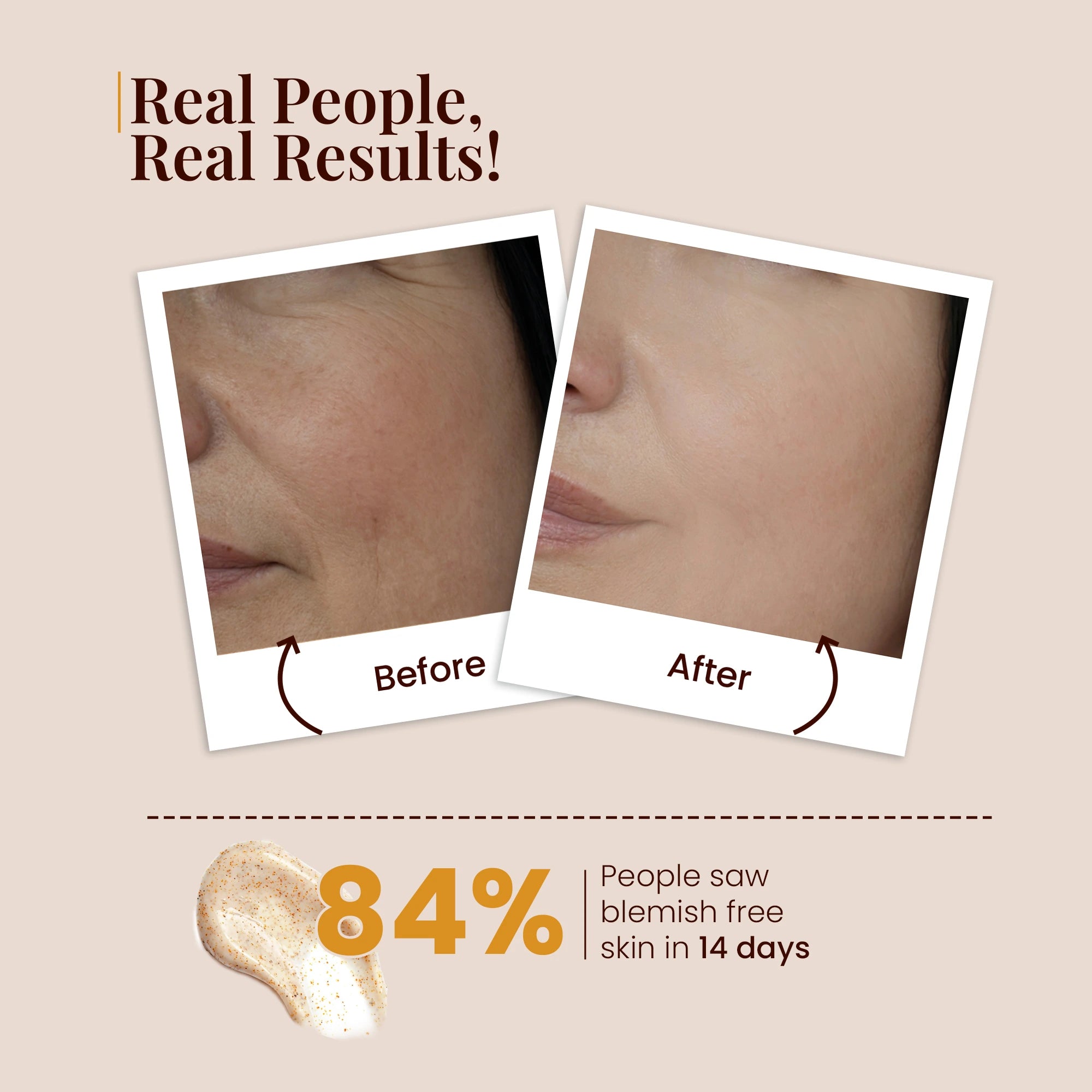 Before and after skin comparison with text &