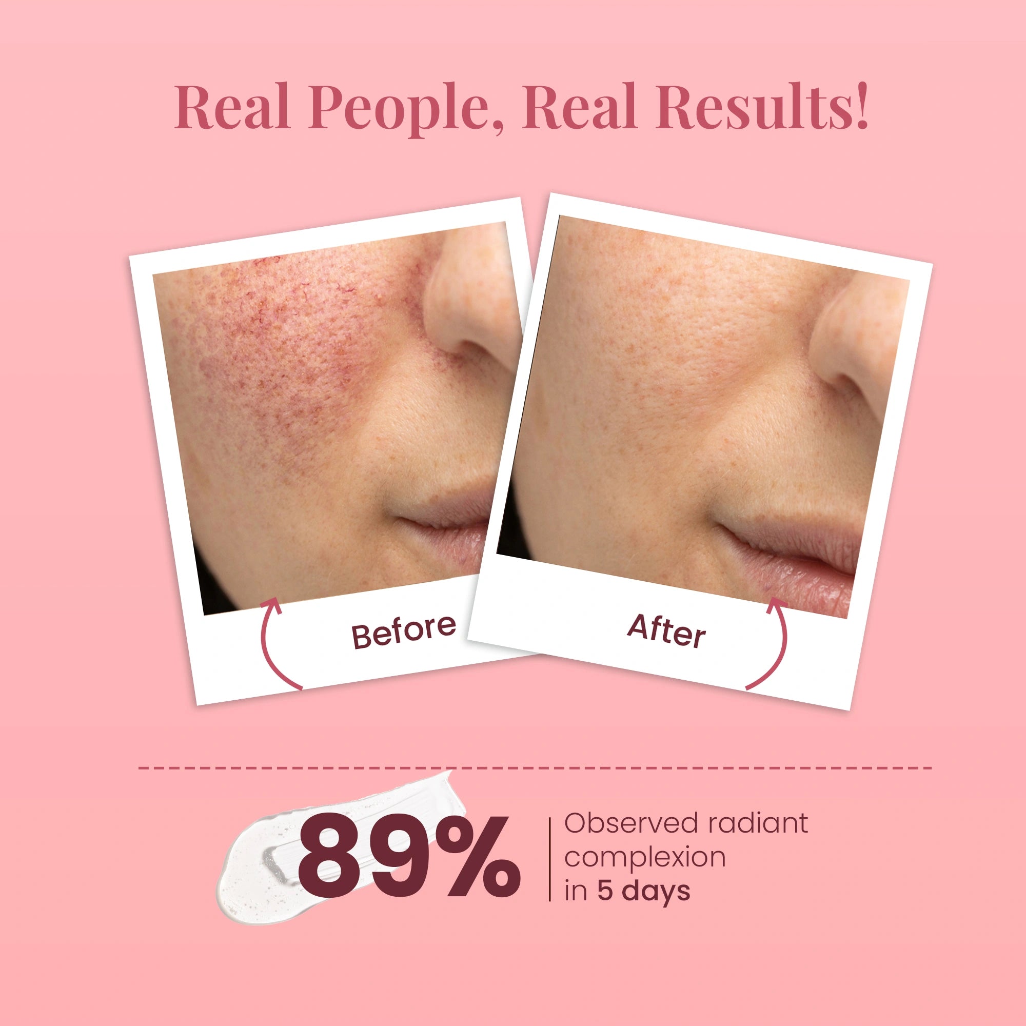 Before and after skin comparison with text on a pink background